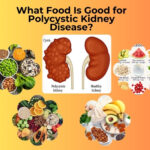 What Food Is Good for Polycystic Kidney Disease?