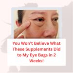 You Won’t Believe What These Supplements Did to My Eye Bags in 2 Weeks